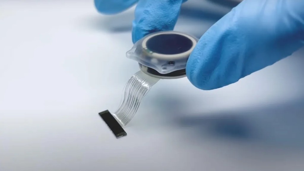 Neuralink: Prvi človek z možganskim čipom